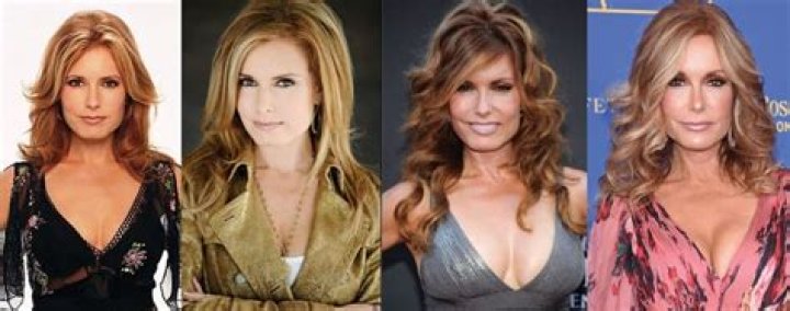 Tracey Bregman Plastic Surgery Before And After: What Happened? Family Explored