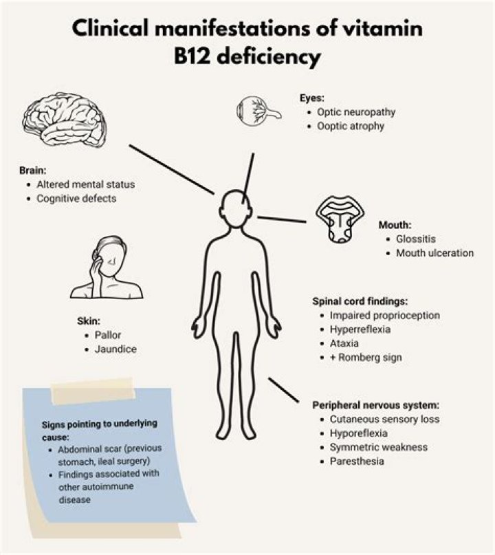 Vitamin B12 deficiency: The telltale sign when waking up after a 'good' night's sleep