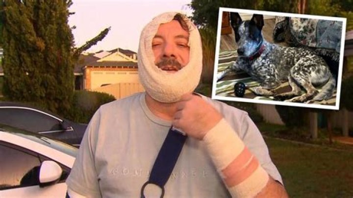 WA police shoot dead Baldivis dog after it attacks three family members, bites owner on the throat