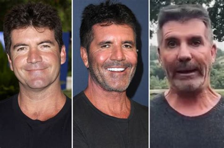 What Happened To Simon Cowell's Face? Fans Concerned With His Disappearing Eyes