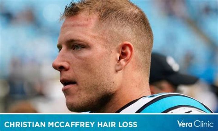 What Is Wrong With NFL Christian McCaffrey Hair? Wig Speculations Explained