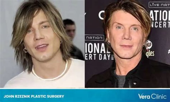 What Plastic Surgery Damaged John Rzeznik Face? Relationship And Net Worth Explored