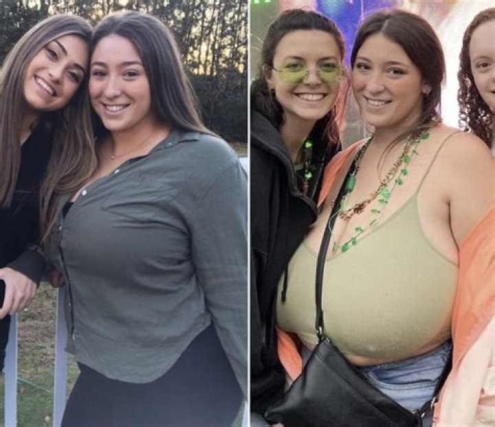 Woman, 41, set to transform her 32K breasts into OOO-cups reveals she's spent £320,000